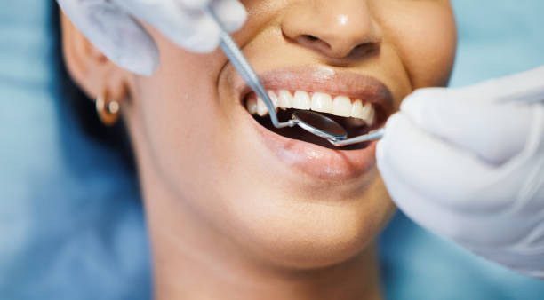 Best Emergency Dental Care for Broken or Chipped Teeth in Goulds, FL