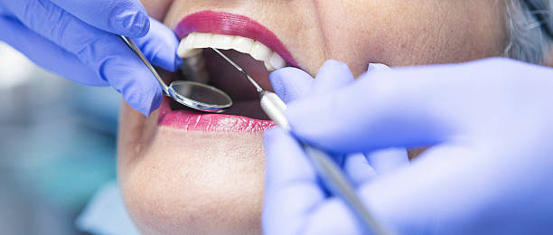 Best Emergency Dental Care for Broken or Chipped Teeth in Goulds, FL
